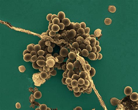 Staphylococcus aureus: A new mechanism involv | EurekAlert!