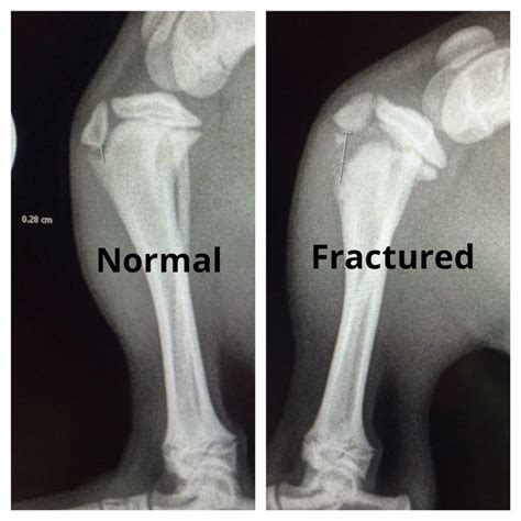 Proximal tibial fracture in a 17week old puppy with open growth plates ...