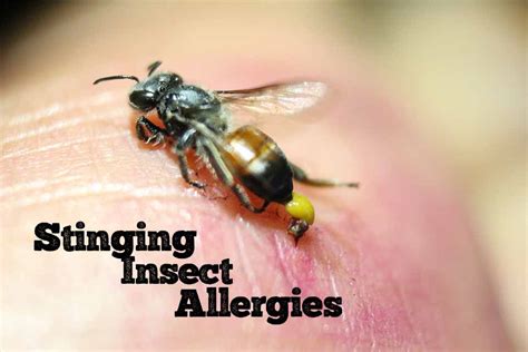 The Danger Behind Stinging Insect Allergy | Arthritis, Autoimmune & Allergy