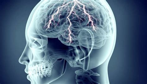 Complex partial seizures: Symptoms and types