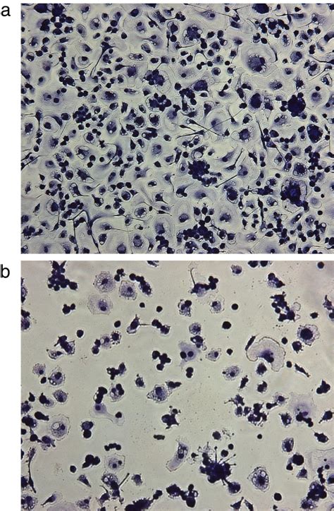 Cytopathic effect on macrophages. a-b: Cytopathic effect on ...