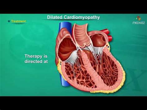 Causes Of Secondary Cardiomyopathy | carfare.me 2019-2020