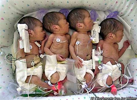 Identical quadruplets born / All 4 baby girls doing fine in Sacramento ...