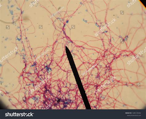 Characteristic Nocardia Spp Using Modified Afb Stock Photo 1285135462 | Shutterstock