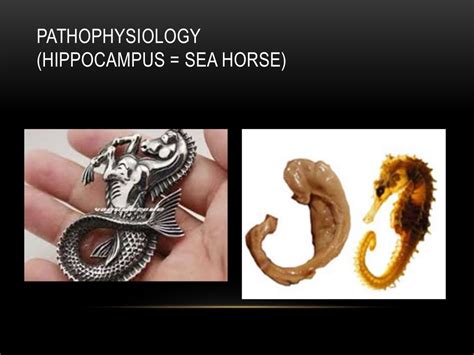 Mesial temporal lobe epilepsy