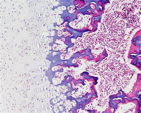 File:Bone histology 016.jpg - Embryology