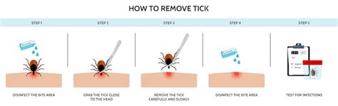 Premium Vector | The correct way to remove a tick insect correctly ...