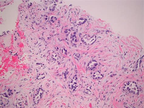 Initial Pathology Assessment