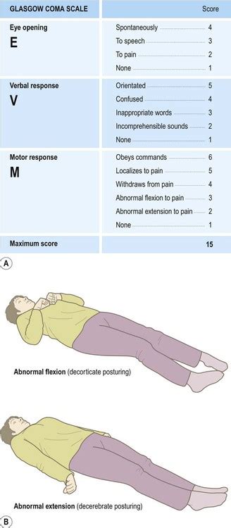 Decorticate Posturing Brain Injury | Bruin Blog