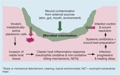 Acute and chronic wound infections: microbiological, immunological, clinical and therapeutic ...