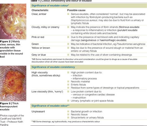 Figure 4 from Wound exudate and the role of dressings. A consensus document. | Semantic Scholar