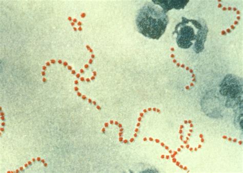 Streptococcus pyogenes — Wikipédia