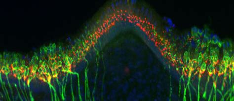 Department of Neuroscience - University of Rochester Medical Center