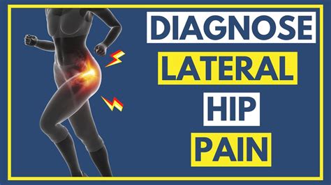 Lateral Hip Pain (GTPS) Diagnosis - Signs & Symptoms - YouTube