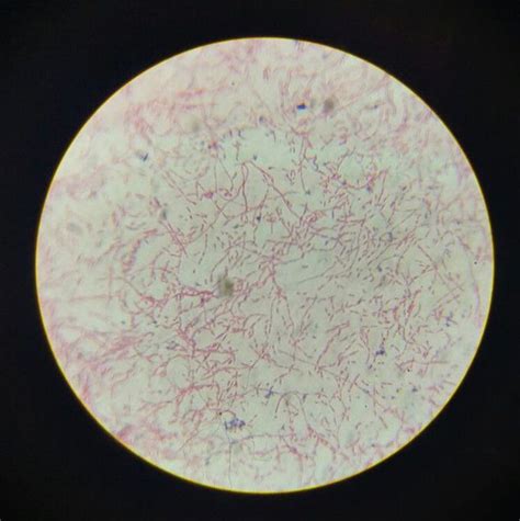 Gram negative bacilli - MEDizzy