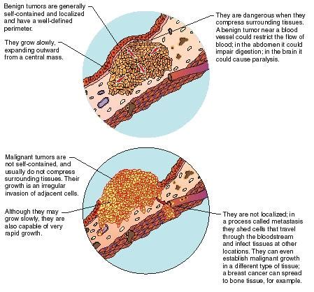 What is Cancer? | Oncogenes and Their Role in Cancer