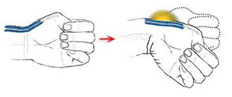 De Quervain’s Tenosynovitis - Causes, Symptoms, Test, Exercise, Surgery