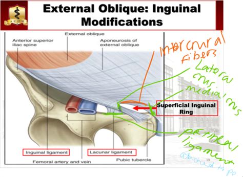 Lacunar Ligament Cadaver