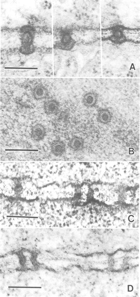 A-D. Ultrastructure of plasmodesmata. A Three images from an embryonic... | Download Scientific ...