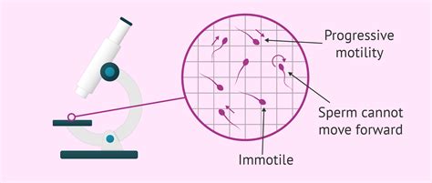 Assessment of sperm motility