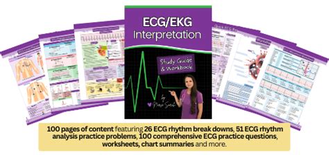 Junctional Tachycardia Rhythm ECG Review