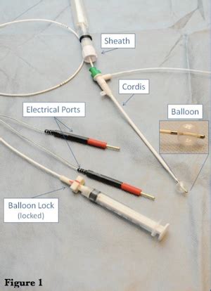 Transvenous Pacemaker Placement - Part 1: The Walkthrough — Taming the SRU