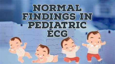 Normal findings in Pediatrics ECG | How to read ECG in children - YouTube