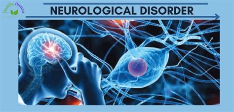 Rare Neurological Disorders In Humans