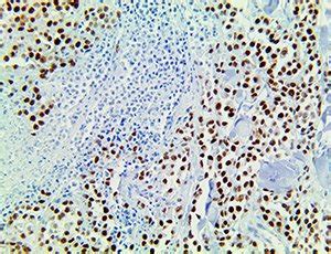 PRAME Antibody (RBT-PRAME) - Bio SB