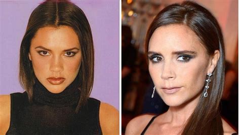 Why Victoria Beckham Will Always Regret Getting Plastic Surgery