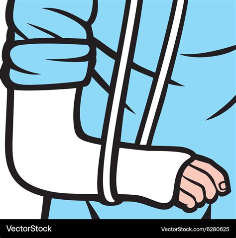 Broken arm in a cast Royalty Free Vector Image