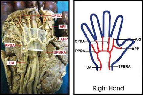 Deep palmar arterial arch | Semantic Scholar