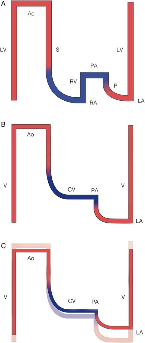 The Fontan circulation after 45 years: update in physiology | Heart