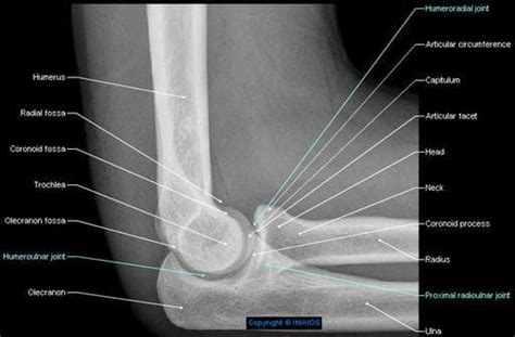 Joint - Cubital region - Radiography - Anatomy : Humeroulnar joint ...