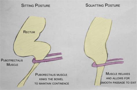 Physio Friday's