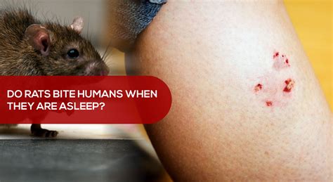 Do rats bite humans when they are asleep?