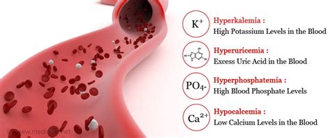 Tumor Lysis SyndromeConners Clinic | Alternative Cancer Coaching