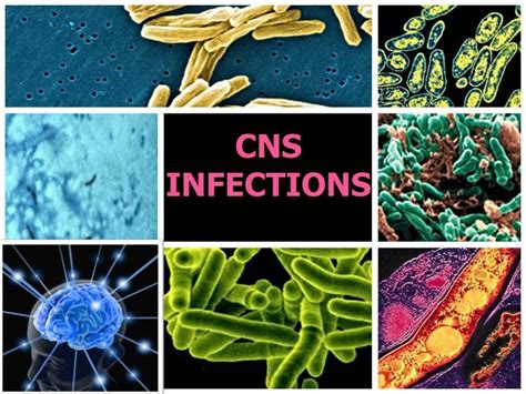 PPT - CNS INFECTIONS PowerPoint Presentation, free download - ID:2398688