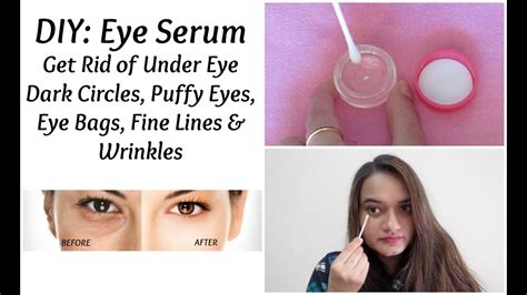 How To Get Rid Of Lines Under Eyes Without Makeup - Mugeek Vidalondon