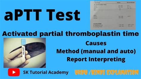 Activated partial thromboplastin time | aPTT test - YouTube