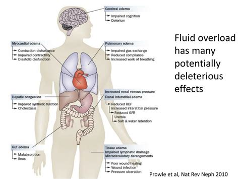 PPT - Fluid Overload and Acute Kidney Injury PowerPoint Presentation, free download - ID:4031841