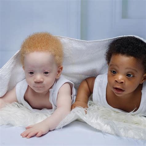 Mom Brings Into The World Black And White Twins And People Often Think That Only One Of Them Is Hers