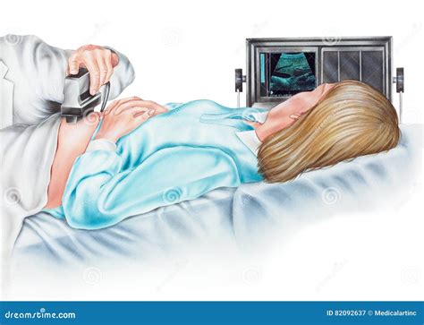 Pregnancy - Ultrasonogram of a Pregnant Woman Stock Illustration ...