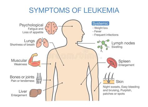 16+ Leukemia Free Stock Photos - StockFreeImages