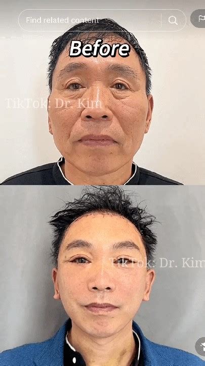 Tiktok Doctor Posts Before And After Pics With Horrifying Results(pictures) - Health - Nigeria