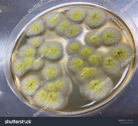 Fungus Aspergilus Brasiliensis Colonies On Scda Stock Photo 1974819950 ...