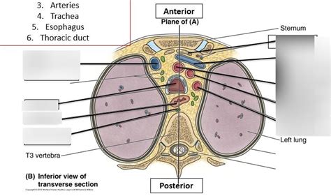 Diagram of T 3 Superior mediastinum cross section | Quizlet