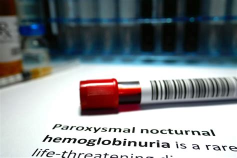 Paroxysmal Nocturnal Hemoglobinuria Epidemiology