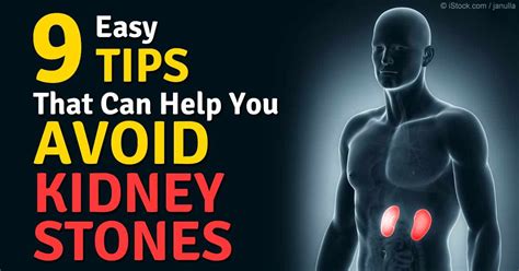 Drinking Water Helps Prevent Kidney Stones | Preventing kidney stones, Kidney stones, Prevention