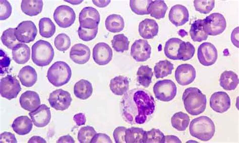 Cytoplasmic Inclusions - Biology Educare